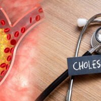 High-Cholesterol-Symptoms