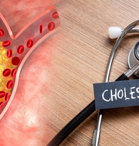 High-Cholesterol-Symptoms