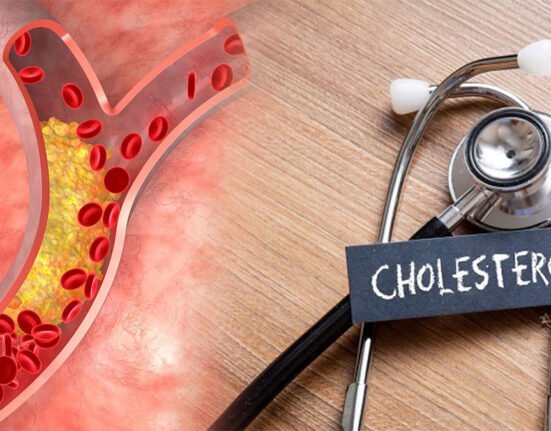 High-Cholesterol-Symptoms